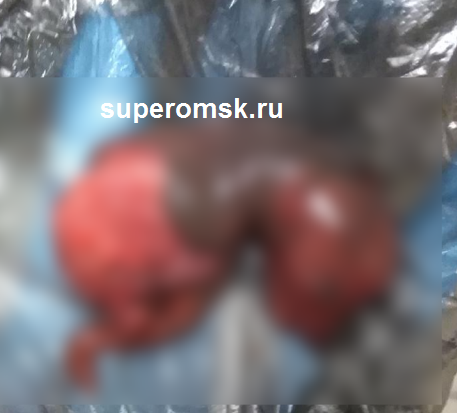 Щенки травмированной омской собаки Моники, попавшей под машину, разорвались и сгнили в утробе Щенки травмированной омской собаки Моники, попавшей под машину, разорвались и сгнили в утробе