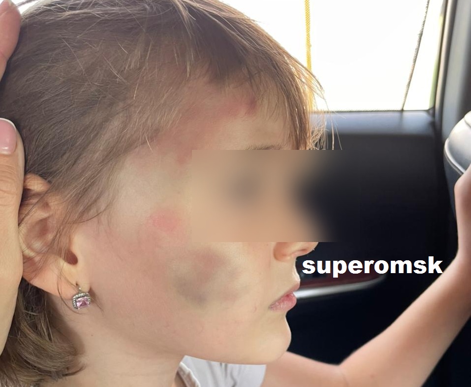 Омичка винит супруга – командира роты в Чечне в жестоком избиении 6-летней дочери Омичка винит супруга – командира роты в Чечне в жестоком избиении 6-летней дочери