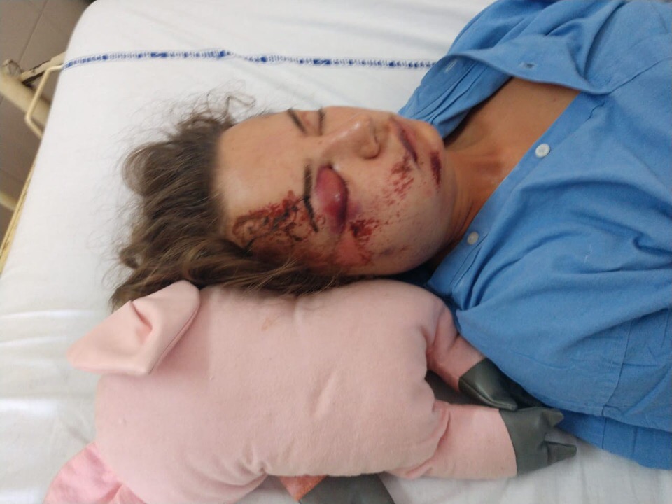 Омичка впала в кому после страшного ДТП на Гоа Омичка впала в кому после страшного ДТП на Гоа