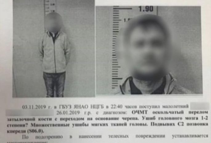 Омич пробил голову 10-месячному младенцу Омич пробил голову 10-месячному младенцу