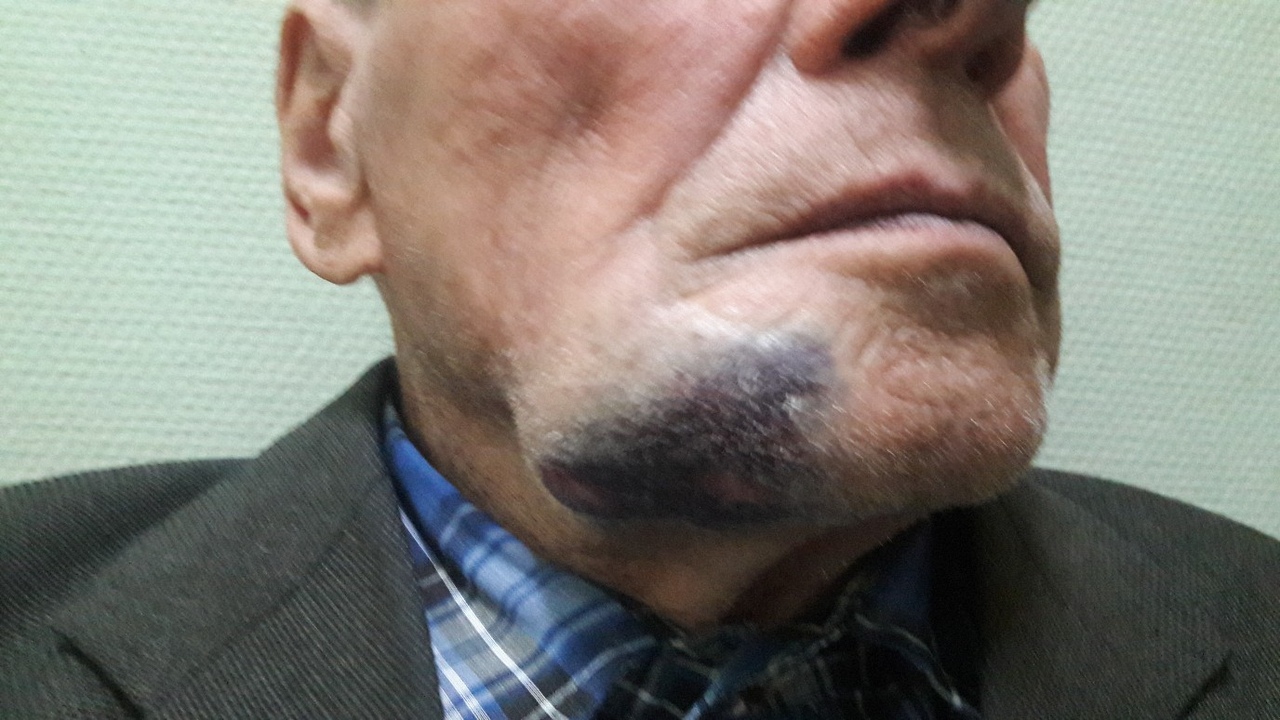 В Омске 89-летний пенсионер показал лицо после избиения за дачный участок В Омске 89-летний пенсионер показал лицо после избиения за дачный участок