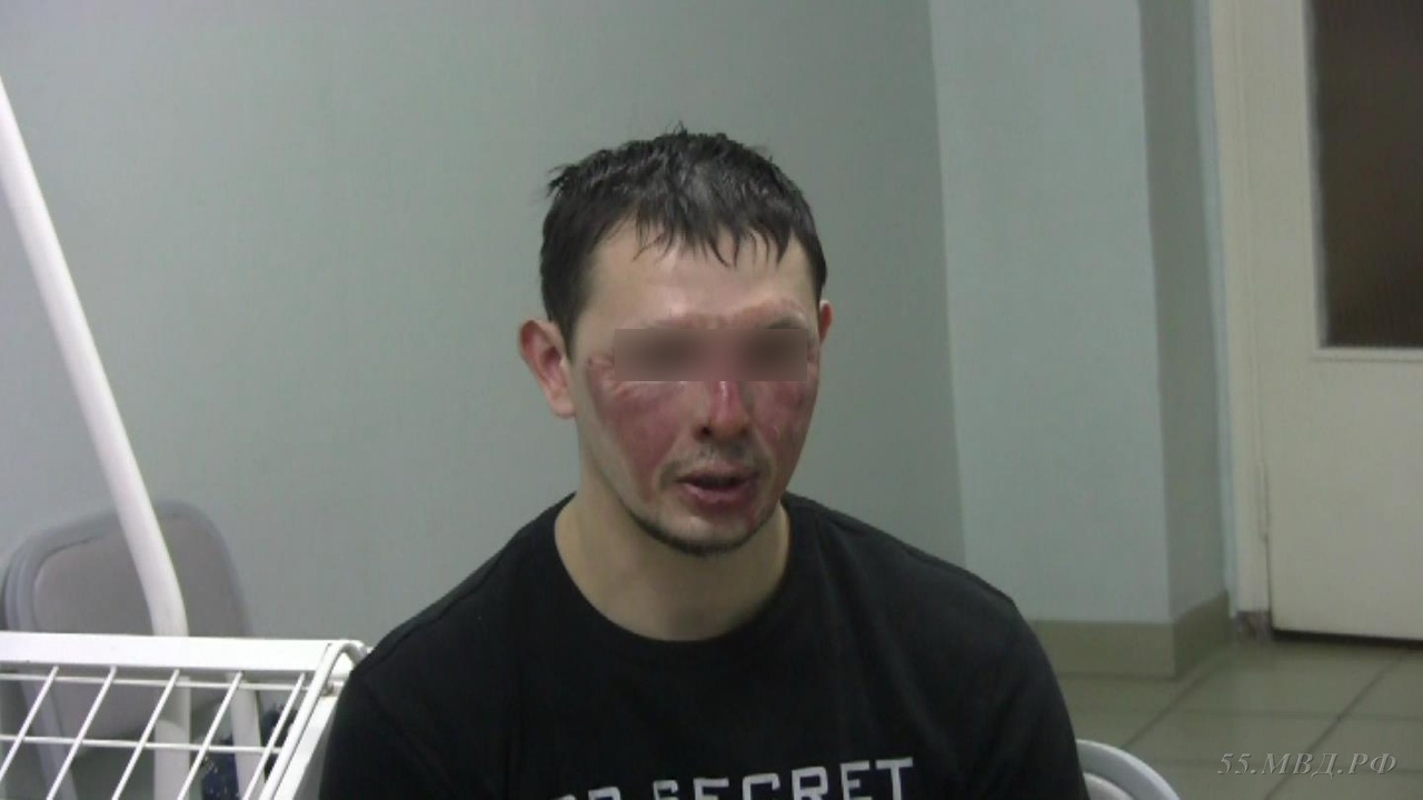 Обгоревший